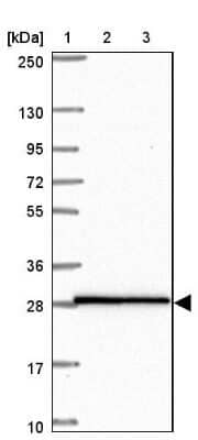 Western Blot: HOXA4 Antibody [NBP2-32515]