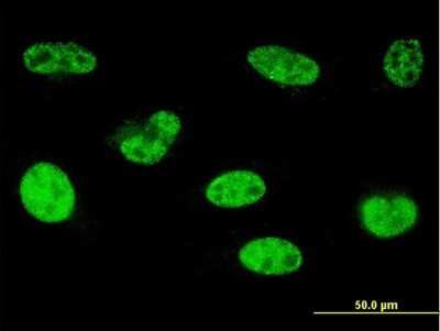 Immunocytochemistry/ Immunofluorescence: HOXA5 Antibody (1D12) [H00003202-M03]