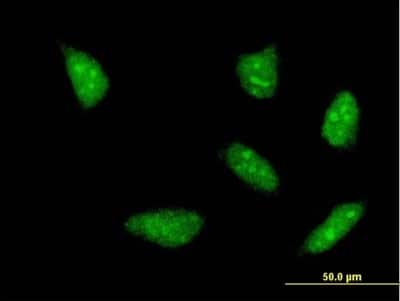 Immunocytochemistry/ Immunofluorescence: HOXA5 Antibody (3C2) [H00003202-M06]