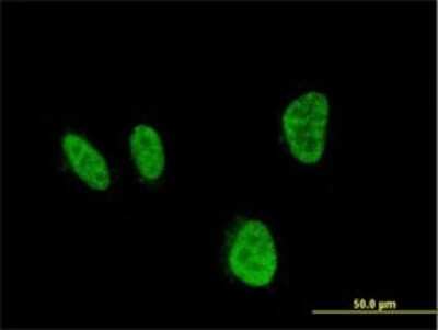 Immunocytochemistry/ Immunofluorescence: HOXA5 Antibody (3E8) [H00003202-M02]