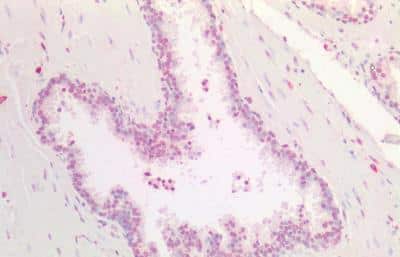 Immunohistochemistry-Paraffin: HOXA5 Antibody [NBP2-42520]