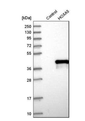 Western Blot: HOXA5 Antibody [NBP1-83235]