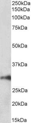 Western Blot: HOXA5 Antibody [NBP2-42520]