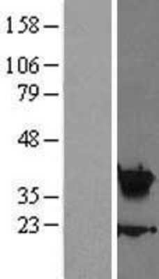 Western Blot: HOXA5 Overexpression Lysate [NBL1-11668]