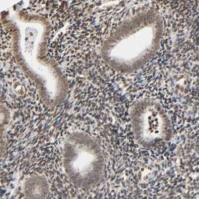 Immunohistochemistry-Paraffin: HOXA6 Antibody [NBP1-83236]