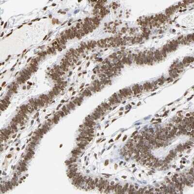 Immunohistochemistry-Paraffin: HOXA6 Antibody [NBP1-83236]