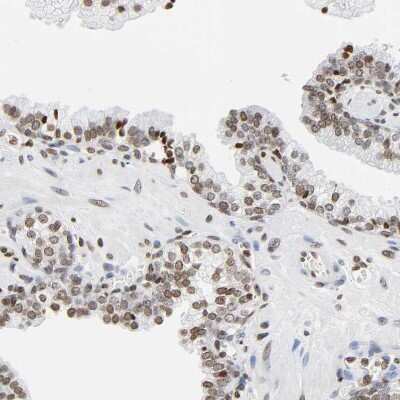 Immunohistochemistry-Paraffin: HOXA6 Antibody [NBP1-83236]
