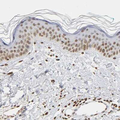 Immunohistochemistry-Paraffin: HOXA6 Antibody [NBP1-83236]