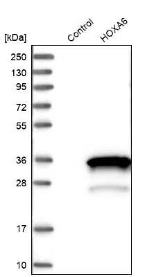 Western Blot: HOXA6 Antibody [NBP1-83236]