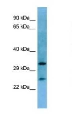 Western Blot: HOXA6 Antibody [NBP1-98346]