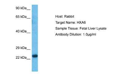 Western Blot: HOXA6 Antibody [NBP2-87586]