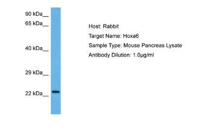 Western Blot: HOXA6 Antibody [NBP2-87588]