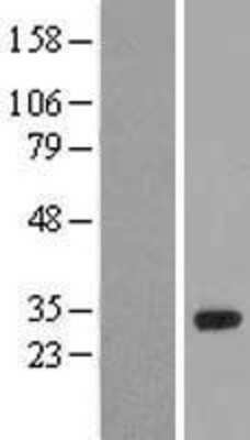 Western Blot: HOXA6 Overexpression Lysate [NBL1-11669]