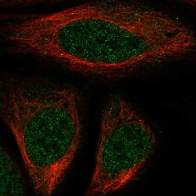 Immunocytochemistry/ Immunofluorescence: HOXA7 Antibody [NBP2-55996]