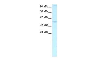 Western Blot: HOXA7 Antibody [NBP2-87589]