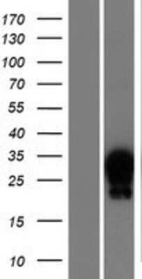 Western Blot: HOXA7 Overexpression Lysate [NBP2-07564]