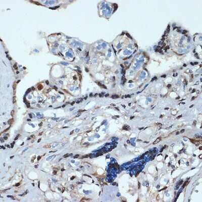 Immunohistochemistry-Paraffin: HOXA9 Antibody (9X1L6) [NBP3-15720]