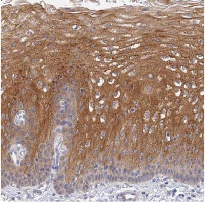 Immunohistochemistry-Paraffin: HOXB1 Antibody [NBP1-83231]