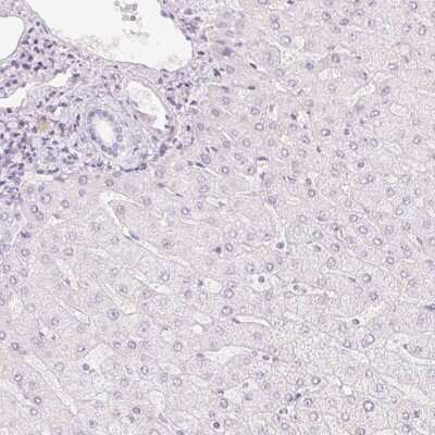 Immunohistochemistry-Paraffin: HOXB13 Antibody [NBP2-48778]