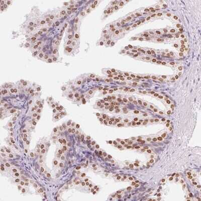 Immunohistochemistry-Paraffin: HOXB13 Antibody [NBP2-48778]