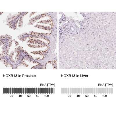 Immunohistochemistry-Paraffin: HOXB13 Antibody [NBP2-48778]