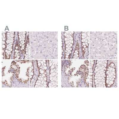 Immunohistochemistry-Paraffin: HOXB13 Antibody [NBP2-48778]
