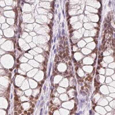 Immunohistochemistry-Paraffin: HOXB13 Antibody [NBP2-48778]