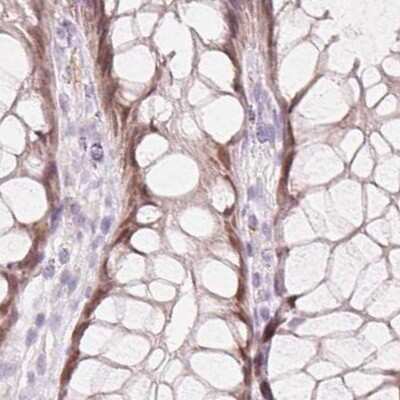 Immunohistochemistry-Paraffin: HOXB13 Antibody [NBP2-48778]