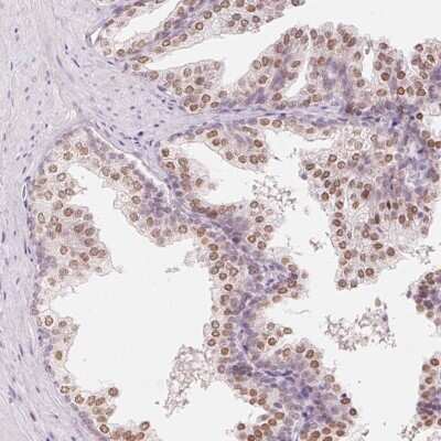 Immunohistochemistry-Paraffin: HOXB13 Antibody [NBP2-49375]