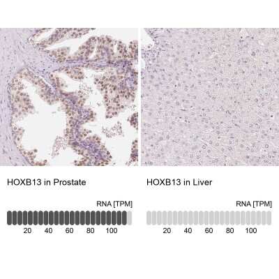 Immunohistochemistry-Paraffin: HOXB13 Antibody [NBP2-49375]