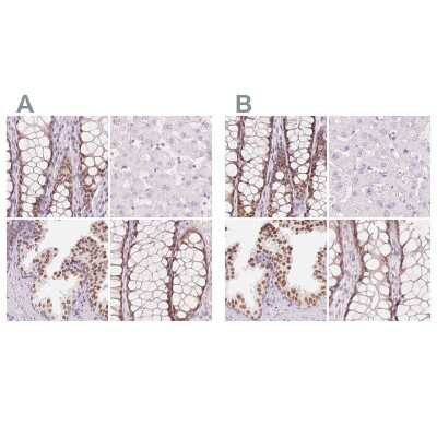 Immunohistochemistry-Paraffin: HOXB13 Antibody [NBP2-49375]