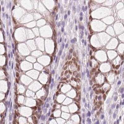 Immunohistochemistry-Paraffin: HOXB13 Antibody [NBP2-49375]