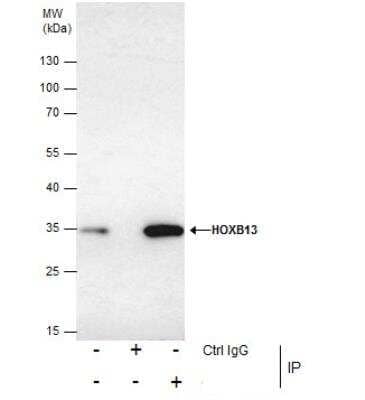Immunoprecipitation: HOXB13 Antibody [NBP2-43655]