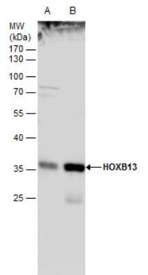 Western Blot: HOXB13 Antibody [NBP2-43655]