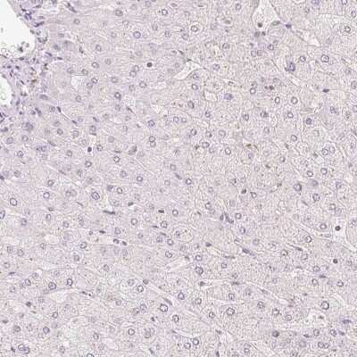 Western Blot: HOXB13 Antibody [NBP2-49375]