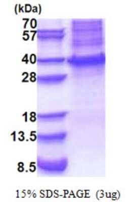 SDS-PAGE: Recombinant Human HOXB13 His Protein [NBP2-23125]