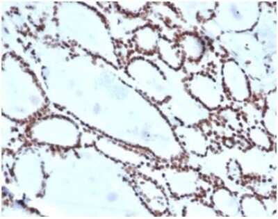 Immunohistochemistry-Paraffin: HOXB2 Antibody (PCRP-HOXB2-1F2) [NBP3-13937]