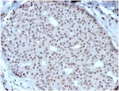 Immunohistochemistry-Paraffin: HOXB2 Antibody (PCRP-HOXB2-1F2) [NBP3-13937]
