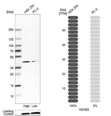 Western Blot: HOXB2 Antibody [NBP2-56905]