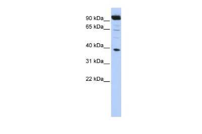 Western Blot: HOXB2 Antibody [NBP2-83055]