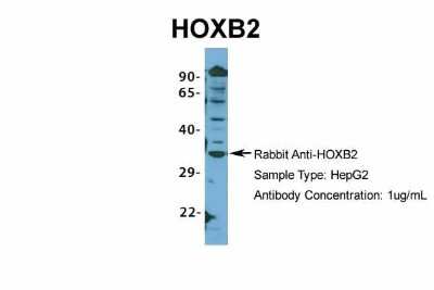 Western Blot: HOXB2 Antibody [NBP2-83055]