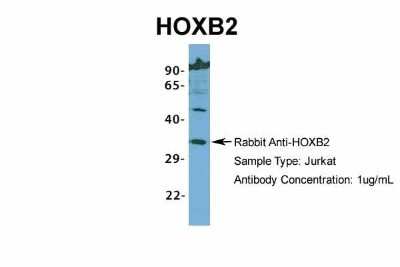 Western Blot: HOXB2 Antibody [NBP2-83055]