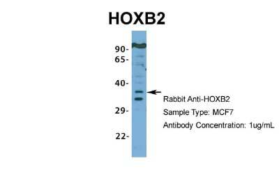 Western Blot: HOXB2 Antibody [NBP2-83055]