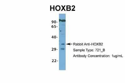 Western Blot: HOXB2 Antibody [NBP2-83055]