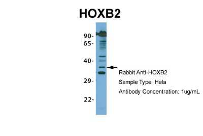 Western Blot: HOXB2 Antibody [NBP2-83055]