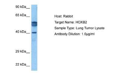 Western Blot: HOXB2 Antibody [NBP2-83056]