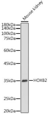 Western Blot: HOXB2 AntibodyAzide and BSA Free [NBP3-15962]