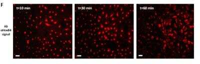 Immunomicroscopy: HOXB4 Antibody (3A2F2) - BSA Free [NBP2-37257]