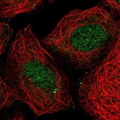 Immunocytochemistry/ Immunofluorescence: HOXB4 Antibody [NBP2-33833]