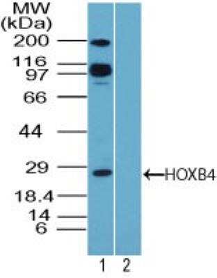 Western Blot: HOXB4 Antibody [NBP2-24561]